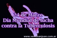 /album/marzo-2014/a2403tuberculosis-jpg/