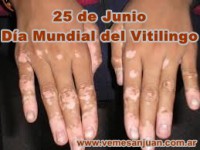 /album/mayo-2014/a2506vitilingo-jpg/